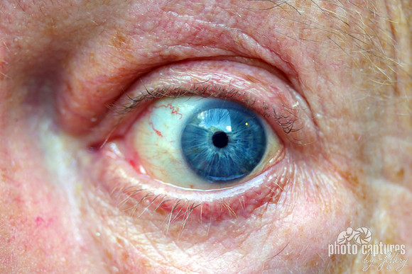 Blue Staring To the Side Eyeball